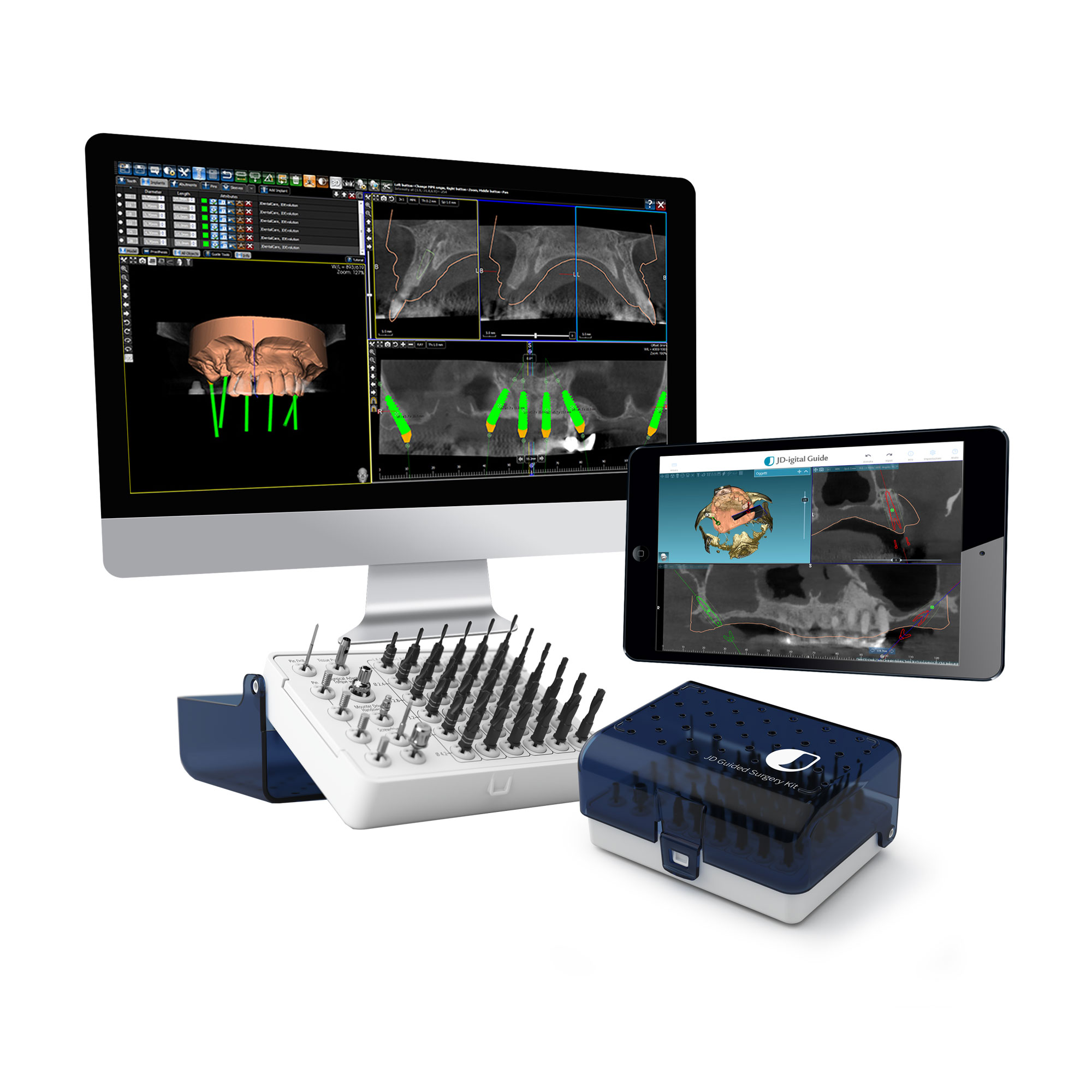Guided Surgery