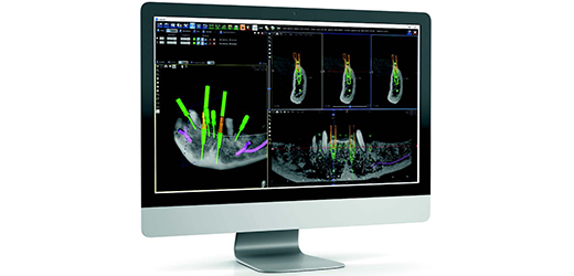 Guided Surgical kit